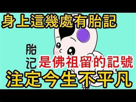 手上有胎記|【手上有胎記】手上有胎記註定富貴？解析胎記位置與命運的神秘。